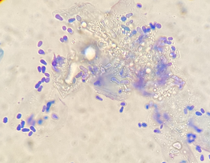 Malasezzia yeast from a dog ear infection